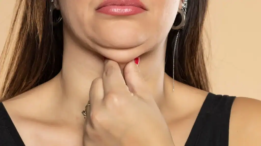An image of a woman with double chin, sad, worried : Non Surgical Double Chin Removal Treatment in Rhyl, UK