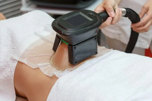 Image of person having fat freezing treatment to help weight gain Rhyl