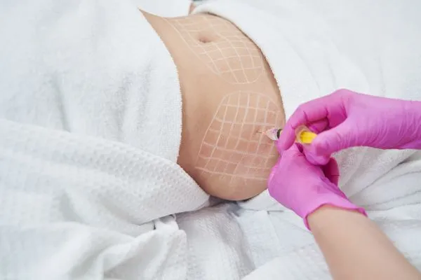 image of fat dissolving injections on love handles to help combat weight gain Rhyl