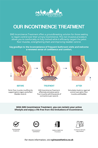 image of how urge incontinence Rhyl treatment works