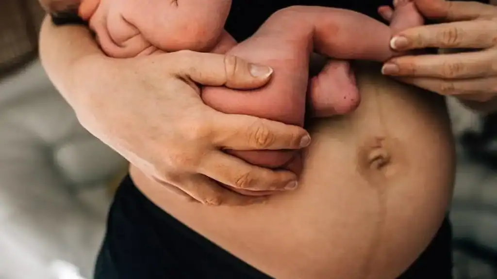 Why Is My Stomach Still Big After Pregnancy Rhyl?